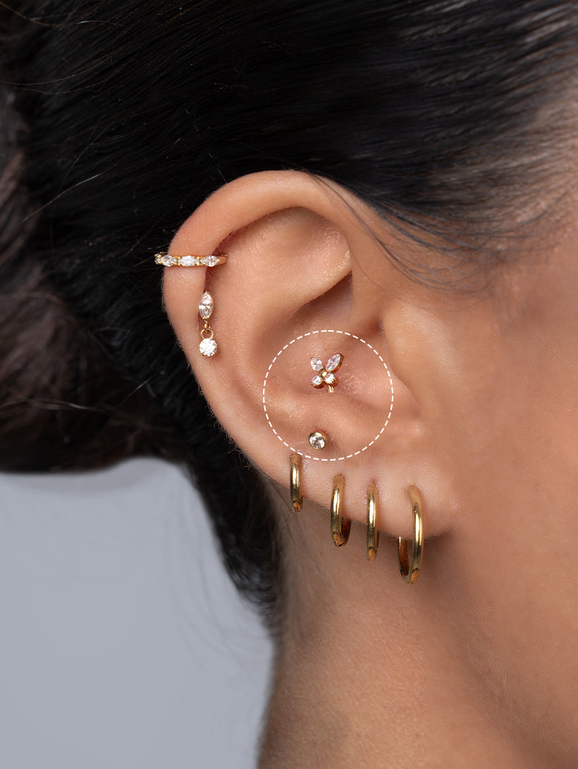 Anti-Tragus