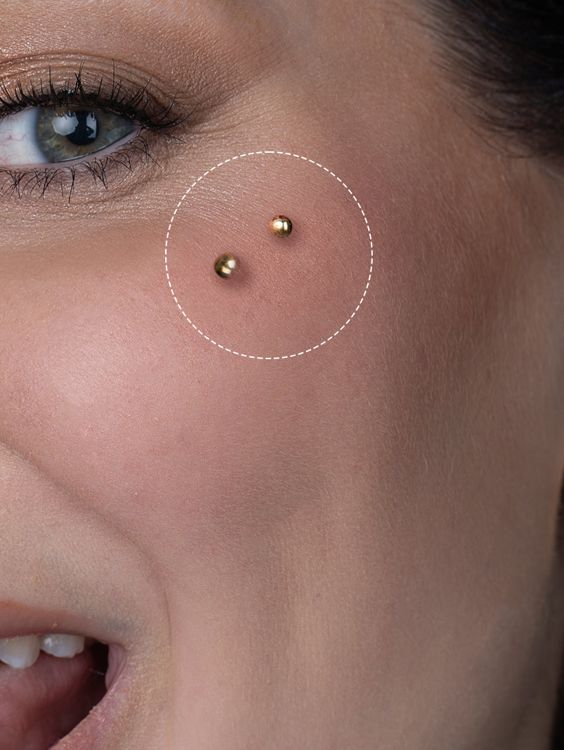 Surface Bar (Staple)